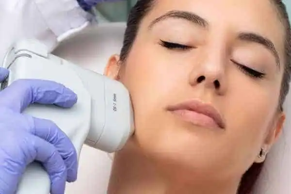 Image of woman having HIFU Blackheath treatment