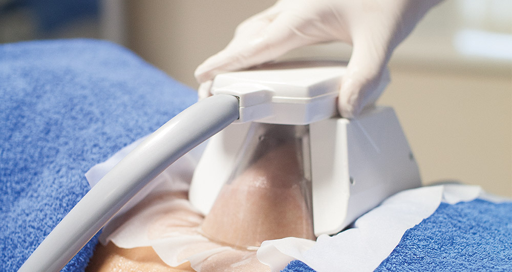 How Fat Freezing and HIFU Work Together? 2 Multiple Areas in One Session HIFU and Fat Freezing Blackheath