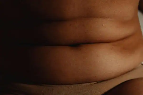 The Hidden Connection: How Stress Shapes Your Fitness and Body Composition 3 image of what stress can do on the stomach area and how Lipo 360 Blackheath can help to change your body shape.
